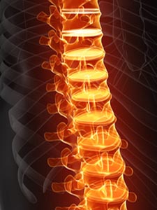 Beschwerden und k&ouml;rperliche  Einschr&auml;nkungen verringern